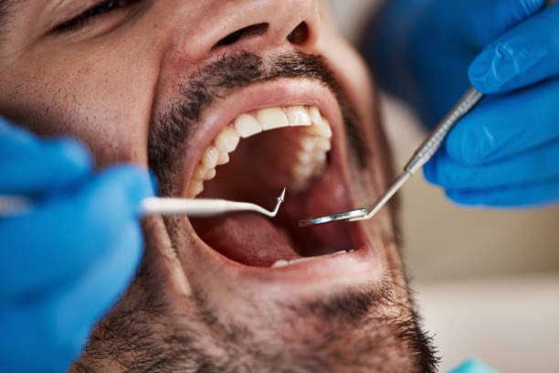 Best Emergency Dental Care for Sports Injuries in Ashland City, TN