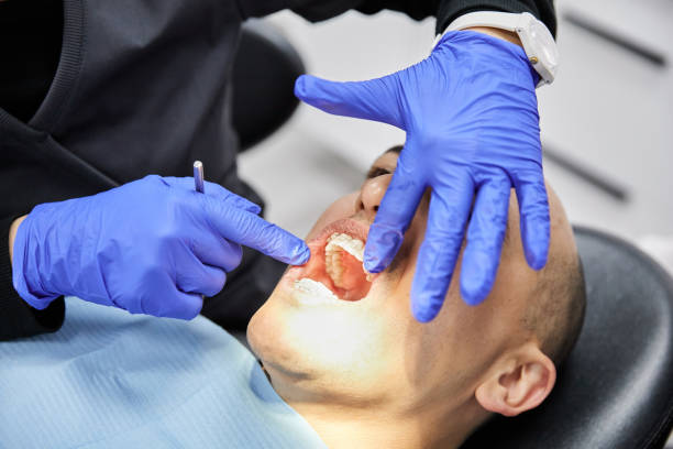 Best Emergency Wisdom Tooth Extraction in Ashland City, TN